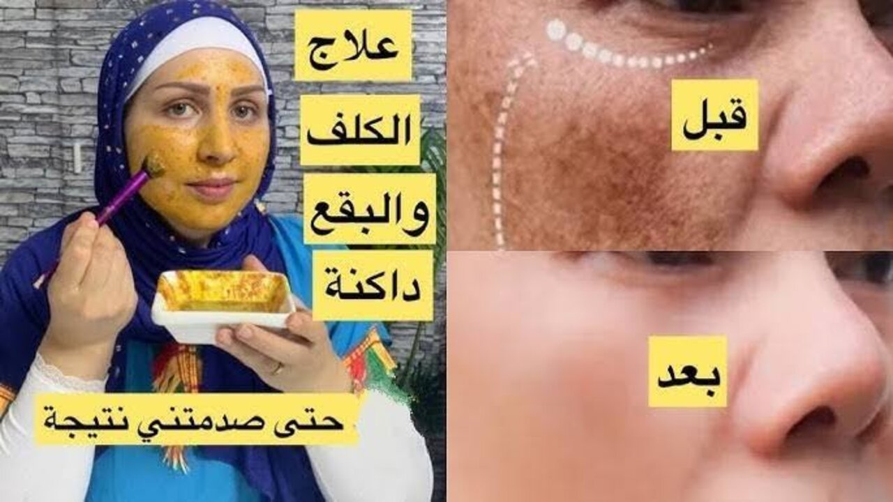 استخدمي ماسك الترمس بتلك الطريقة للتخلص من مشاكل بشرتك القديمة نهائياً