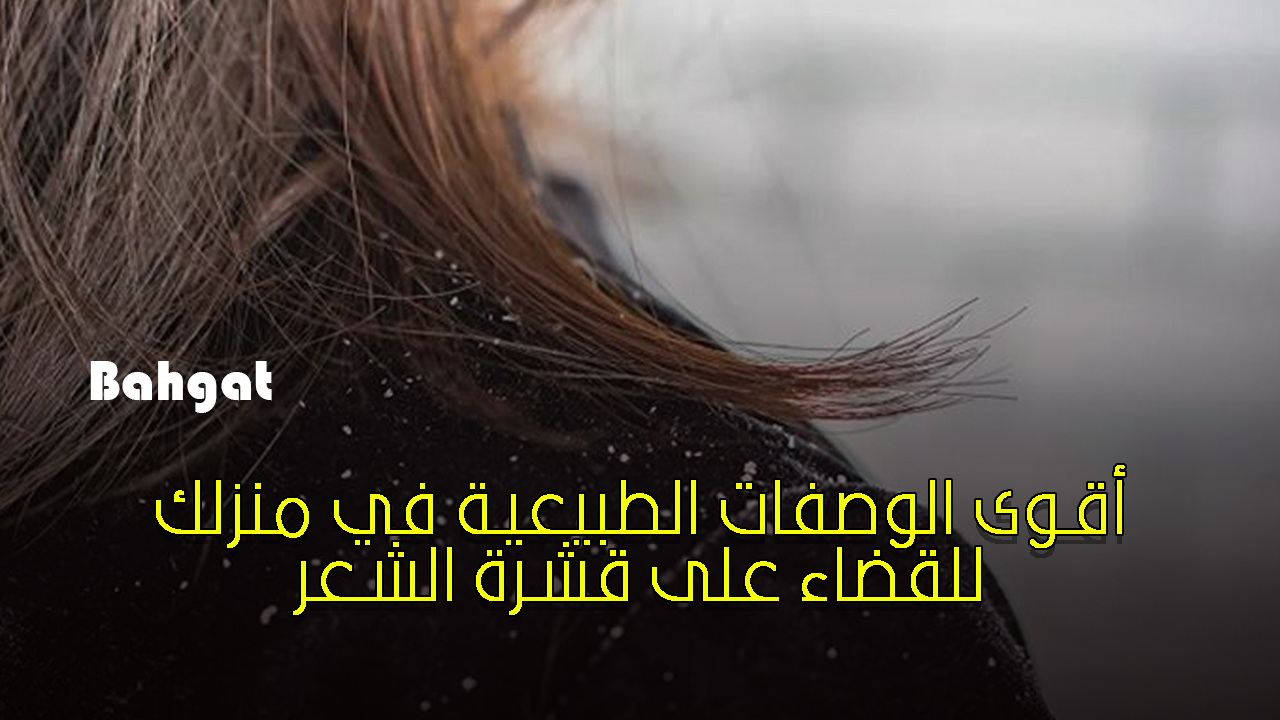 “هتختفي للأبد” مكونات منزلية للتخلص من قشرة الشعر في أقل وقت ممكن